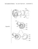 WIND SUPPRESSION/REPLACEMENT COMPONENT FOR USE WITH ELECTRONIC SYSTEMS diagram and image