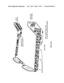 Hearing Assistance System diagram and image