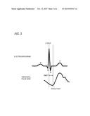 HEMODYNAMICS MEASUREMENT APPARATUS AND HEMODYNAMICS MEASUREMENT METHOD diagram and image