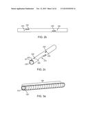 DEVICE AND METHOD FOR POSITIONING AN ELECTRODE IN A BODY CAVITY diagram and image