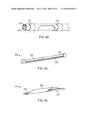 DEVICE AND METHOD FOR POSITIONING AN ELECTRODE IN A BODY CAVITY diagram and image