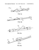 DEVICE AND METHOD FOR POSITIONING AN ELECTRODE IN A BODY CAVITY diagram and image