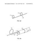 DEVICE AND METHOD FOR POSITIONING AN ELECTRODE IN A BODY CAVITY diagram and image