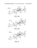 DEVICE AND METHOD FOR POSITIONING AN ELECTRODE IN A BODY CAVITY diagram and image