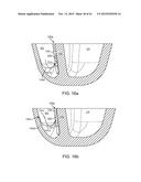 DEVICE AND METHOD FOR POSITIONING AN ELECTRODE IN A BODY CAVITY diagram and image