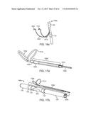 DEVICE AND METHOD FOR POSITIONING AN ELECTRODE IN A BODY CAVITY diagram and image