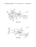 DEVICE AND METHOD FOR POSITIONING AN ELECTRODE IN A BODY CAVITY diagram and image