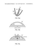 DEVICE AND METHOD FOR POSITIONING AN ELECTRODE IN A BODY CAVITY diagram and image