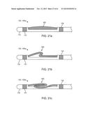 DEVICE AND METHOD FOR POSITIONING AN ELECTRODE IN A BODY CAVITY diagram and image