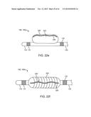 DEVICE AND METHOD FOR POSITIONING AN ELECTRODE IN A BODY CAVITY diagram and image