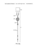 DEVICE AND METHOD FOR POSITIONING AN ELECTRODE IN A BODY CAVITY diagram and image