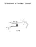 DEVICE AND METHOD FOR POSITIONING AN ELECTRODE IN A BODY CAVITY diagram and image