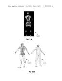 SYSTEM AND METHOD FOR PREVENTING DECUBITUS ULCERS diagram and image