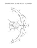 LABOR MANAGEMENT DEVICES FOR PELVIC FLOOR SUPPORT diagram and image