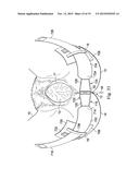 LABOR MANAGEMENT DEVICES FOR PELVIC FLOOR SUPPORT diagram and image