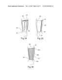 ELASTOMERIC PARTICLE HAVING AN ELECTRICALLY CONDUCTING  SURFACE, A     PRESSURE SENSOR COMPRISING SAID PARTICLES, A METHOD  FOR PRODUCING SAID     SENSOR AND A SENSOR SYSTEM COMPRISING SAID  SENSORS diagram and image