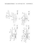 SYSTEMS AND METHODS FOR INCREASED OPERATING ROOM EFFICIENCY diagram and image