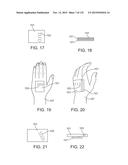 SYSTEMS AND METHODS FOR INCREASED OPERATING ROOM EFFICIENCY diagram and image