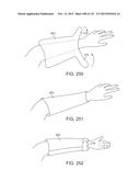 SYSTEMS AND METHODS FOR INCREASED OPERATING ROOM EFFICIENCY diagram and image