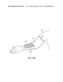 SYSTEMS AND METHODS FOR INCREASED OPERATING ROOM EFFICIENCY diagram and image