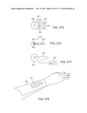 SYSTEMS AND METHODS FOR INCREASED OPERATING ROOM EFFICIENCY diagram and image