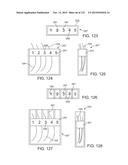 SYSTEMS AND METHODS FOR INCREASED OPERATING ROOM EFFICIENCY diagram and image