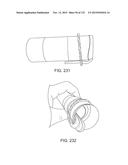 SYSTEMS AND METHODS FOR INCREASED OPERATING ROOM EFFICIENCY diagram and image