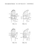 SYSTEMS AND METHODS FOR INCREASED OPERATING ROOM EFFICIENCY diagram and image