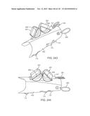 SYSTEMS AND METHODS FOR INCREASED OPERATING ROOM EFFICIENCY diagram and image