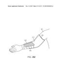 SYSTEMS AND METHODS FOR INCREASED OPERATING ROOM EFFICIENCY diagram and image