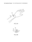 SYSTEMS AND METHODS FOR INCREASED OPERATING ROOM EFFICIENCY diagram and image