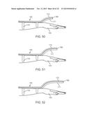 SYSTEMS AND METHODS FOR INCREASED OPERATING ROOM EFFICIENCY diagram and image