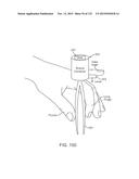 SYSTEMS AND METHODS FOR INCREASED OPERATING ROOM EFFICIENCY diagram and image