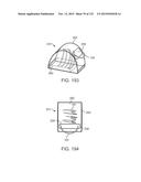 SYSTEMS AND METHODS FOR INCREASED OPERATING ROOM EFFICIENCY diagram and image