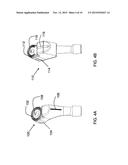 FEMORAL REAMING SYSTEM AND METHOD OF PERFORMING TRIAL REDUCTION diagram and image