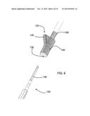 FEMORAL REAMING SYSTEM AND METHOD OF PERFORMING TRIAL REDUCTION diagram and image