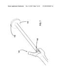 FEMORAL REAMING SYSTEM AND METHOD OF PERFORMING TRIAL REDUCTION diagram and image