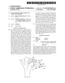 Patient-Specific Elbow Guides And Associated Methods diagram and image