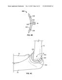 Patient-Specific Elbow Guides And Associated Methods diagram and image