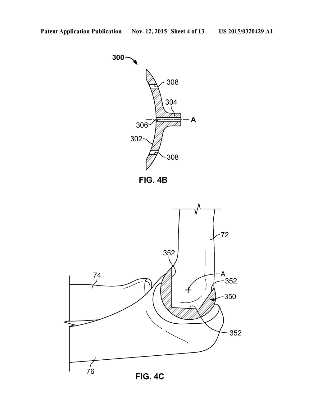 Patient-Specific Elbow Guides And Associated Methods - diagram, schematic, and image 05