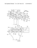 Patient-Specific Elbow Guides And Associated Methods diagram and image