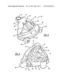 Humeral Cut Guide diagram and image