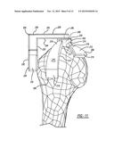 Humeral Cut Guide diagram and image