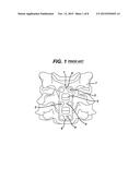 SPINAL PLATE AND DRILL GUIDE diagram and image