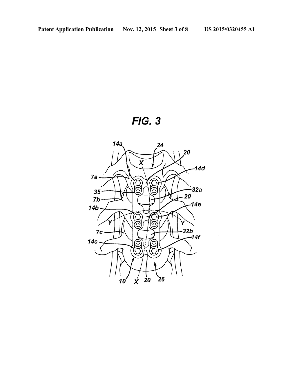 SPINAL PLATE AND DRILL GUIDE - diagram, schematic, and image 04