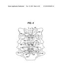 SPINAL PLATE AND DRILL GUIDE diagram and image