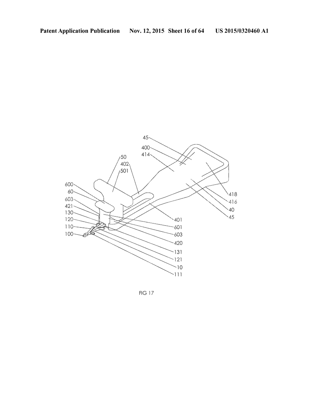 METHOD AND APPARATUS FOR AN INTRAMUDULLARY IMPLANT AND METHOD OF     IMPLANTATION THEREOF - diagram, schematic, and image 17