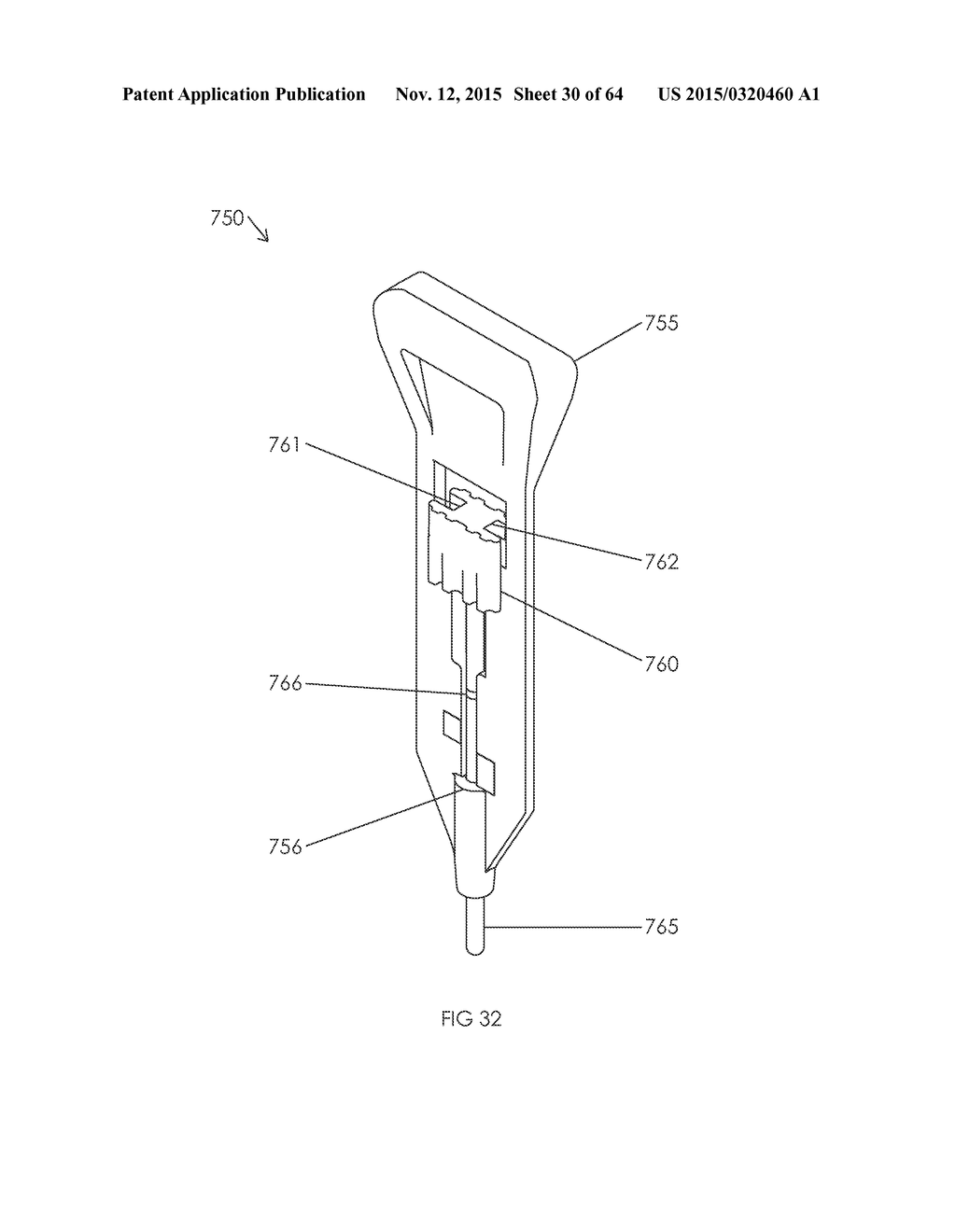 METHOD AND APPARATUS FOR AN INTRAMUDULLARY IMPLANT AND METHOD OF     IMPLANTATION THEREOF - diagram, schematic, and image 31