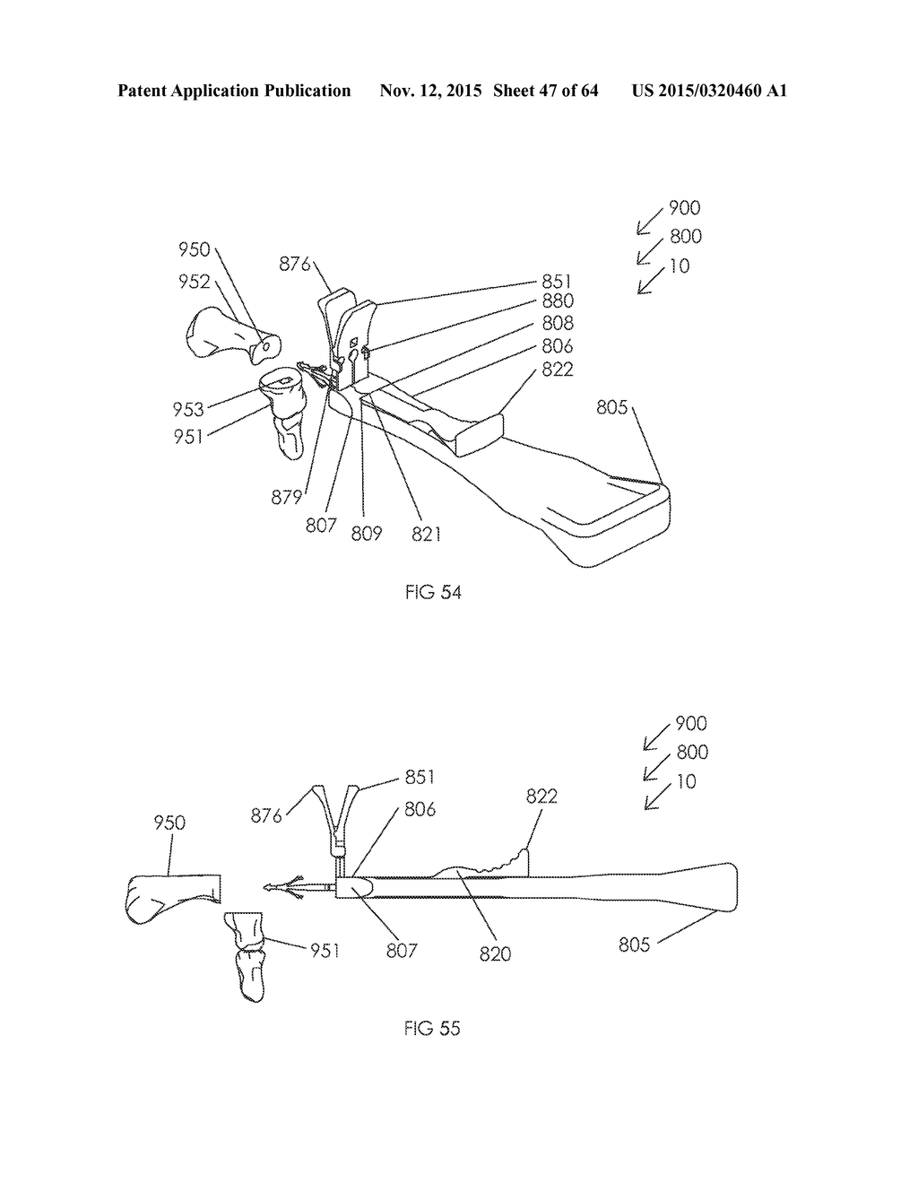 METHOD AND APPARATUS FOR AN INTRAMUDULLARY IMPLANT AND METHOD OF     IMPLANTATION THEREOF - diagram, schematic, and image 48