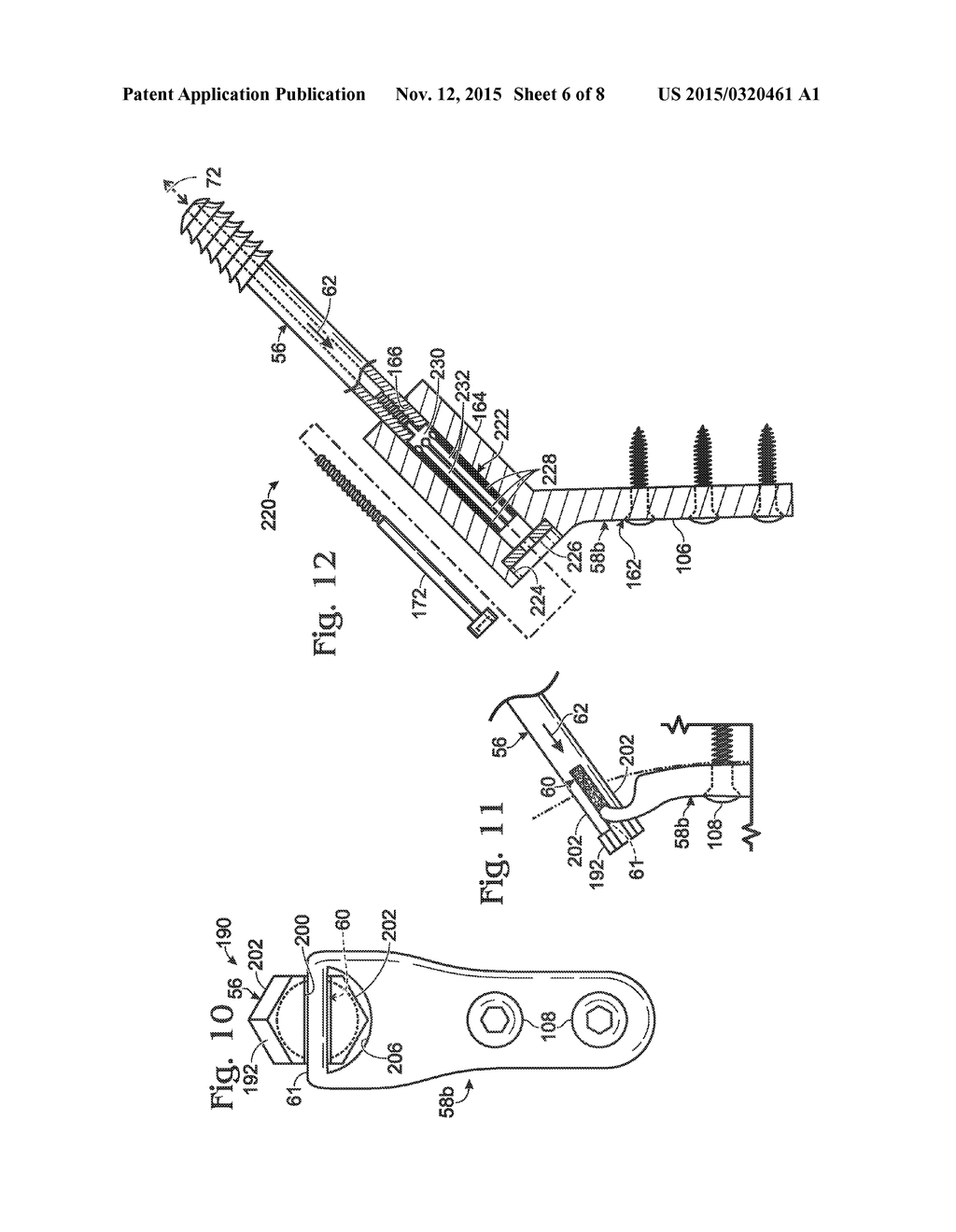 HIP FIXATION WITH LOAD-CONTROLLED DYNAMIZATION - diagram, schematic, and image 07